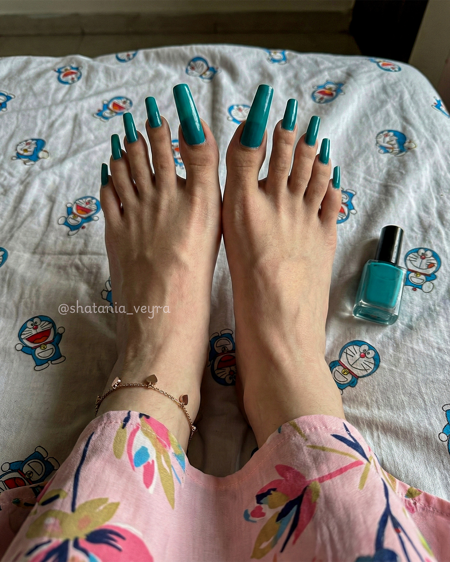 cracked heels before after care — well-maintained feet showing smooth healthy skin
