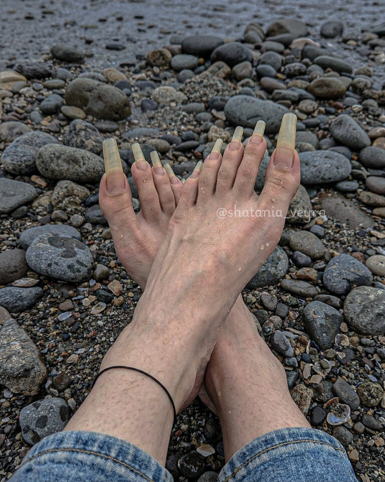 Cracked Heels: How to Fix and Prevent Them for Good